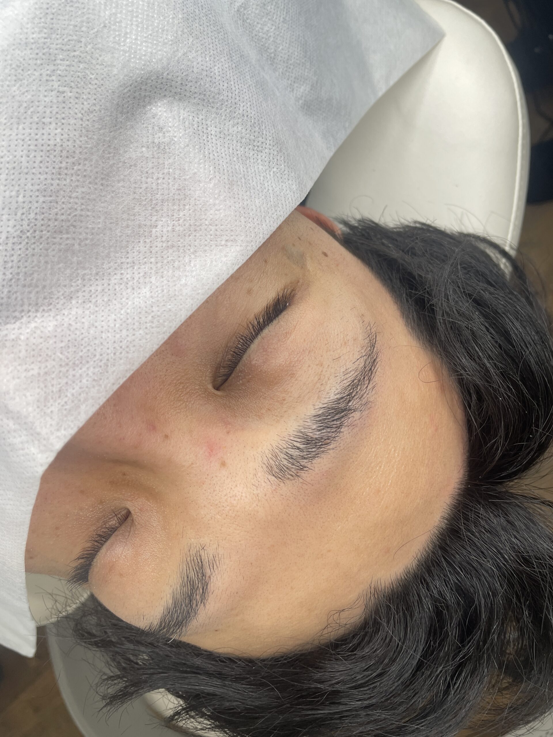 BEFORE